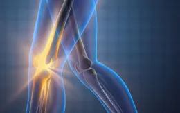 Các bệnh lý xương khớp nguy hiểm hay gặp nhất