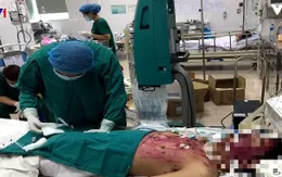 Tự ý dùng thuốc, bệnh nhân mắc thủy đậu tử vong