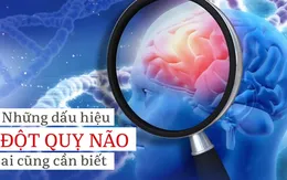 Dấu hiệu và cách phòng ngừa tai biến mạch máu não