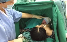 Lợi ích từ biện pháp da kề da và kẹp cắt rốn muộn trong mổ đẻ