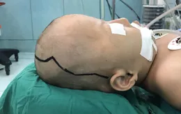 Chuyên gia thẩm mỹ Hoa Kỳ phẫu thuật ca bệnh khó tại Việt Nam