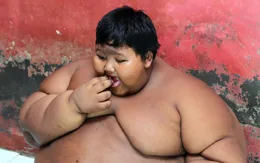 Cảnh báo nguy cơ bùng nổ nạn béo phì trên thế giới