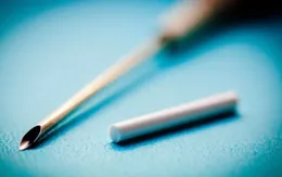 Nên cấy que tránh thai vào thời điểm nào?