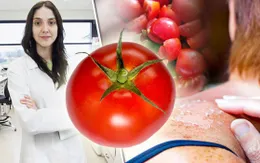Những thực phẩm giúp chống lại tác hại của tia UV