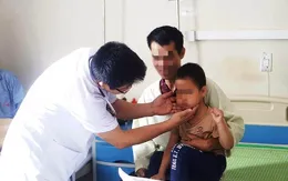 Cậu bé 5 tuổi ria mép rậm, mọc lông đầy mặt