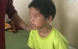 Bé trai 11 tuổi uống 1 lít rượu bị hôn mê đã tỉnh lại