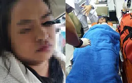 Người phụ nữ bị chì kẻ mắt cắm vào mắt khi trang điểm trên taxi
