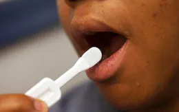 Xét nghiệm nước bọt để tìm ung thư tuyến tiền liệt