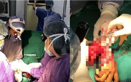 9 giờ nối thành công bàn tay đứt lìa cho một bệnh nhân nam 21 tuổi