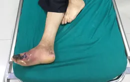 Đái tháo đường - "Kẻ giết người" thầm lặng