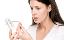 Làm gì để ngăn rụng tóc do căng thẳng