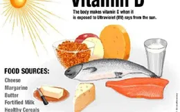 Còi xương do thiếu vitamin D ở trẻ em