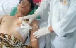 Bị đâm thủng tim do ngã vào dao gọt trái cây