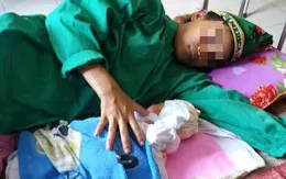 Hiến máu cứu sản phụ bị sốc nặng do băng huyết sau sinh