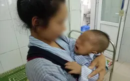 Trẻ 7 tháng tuổi phải khoét bỏ mắt vì mẹ nhỏ sữa chữa đỏ mắt