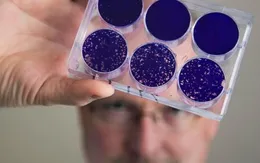 Virus bại liệt mang lại hy vọng mới chữa khỏi ung thư não