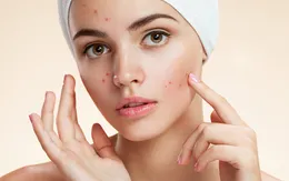 Những tổn thương da vùng mặt hay gặp
