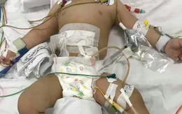 Người mẹ tâm thần dùng dao đâm vào bụng con trai 11 tháng tuổi