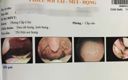Viêm loét miệng, lưỡi sau khi đi phun thuốc diệt cỏ