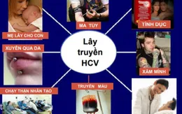 Viêm gan C không còn là nỗi ám ảnh