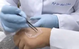 Vết thương mau lành nhờ băng dán làm từ dứa