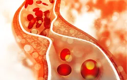 Lượng cholesterol "tốt" có thể ảnh hưởng xấu đến một số người