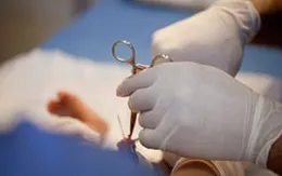 Suýt mất "cậu nhỏ" sau khi cắt bao quy đầu ở phòng khám tư
