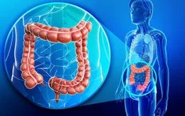 Sàng lọc sớm ung thư đại trực tràng