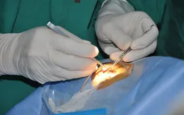 Hai bé trai được ghép giác mạc của Vân Nhi