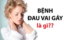 Giới văn phòng và nguy cơ thoái hóa đốt sống cổ