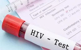 Sử dụng thuốc ARV đúng chỉ định sẽ ngăn ngừa lây nhiễm HIV
