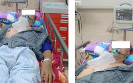 Cảnh báo nguy hiểm khi tự điều trị tăng huyết áp, đái tháo đường