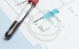 Giải đáp 6 thắc mắc thường gặp về cholesterol