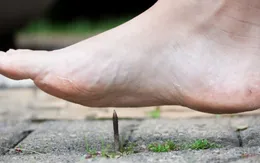Hiểu về bệnh uốn ván