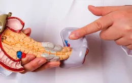 Phòng ngừa ung thư tuyến tụy thế nào?