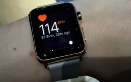 Phát hiện nhịp tim bất thường nhờ đồng hồ Apple Watch