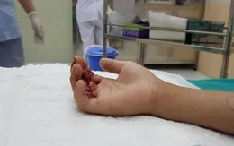 Xô đẩy nhau trong lúc chơi, trẻ bị ngã kẹp tay vào thang máy