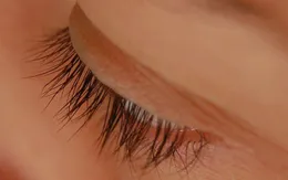 Rụng toàn bộ lông mi vì nối mi ở tiệm