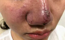 Hà Nội tăng cường kiểm tra, xử lý hoạt động của các cơ sở dịch vụ thẩm mỹ