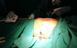 Bé trai 7 tuổi mang trong mình hai dị tật hiếm gặp