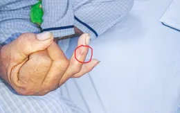Cẩn trọng: Rắn lục đuôi đỏ tấn công