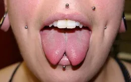 Hiểm hoạ từ sở thích bấm khuyên và xẻ lưỡi