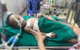 Bé trai 19 tháng tuổi bị đạn bi súng hơi bắn vào ngực phải