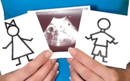 Nước Anh kêu gọi không tiết lộ giới tính thai nhi nhằm giảm nạo phá thai