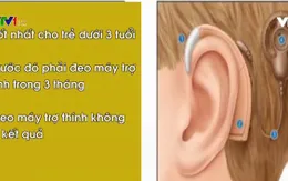 Ốc tai điện tử cải thiện khả năng nghe cho người nghe kém