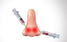 Ham rẻ, nữ sinh viên có nguy cơ mù mắt sau khi tiêm filler