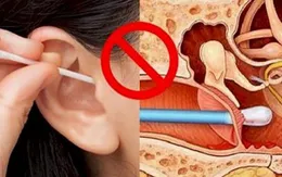 Hiểm họa từ việc lấy ráy tai không đúng cách