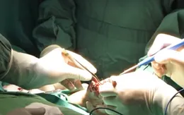 Bé trai 7 tuổi bị nát 2 bàn tay do điện thoại phát nổ