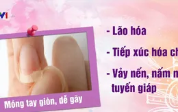 Nhìn vào móng tay có thể biết ngay tình trạng sức khỏe