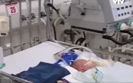 Bệnh viện Nhi Trung ương kêu gọi hỗ trợ bệnh nhi con nạn nhân chết cháy